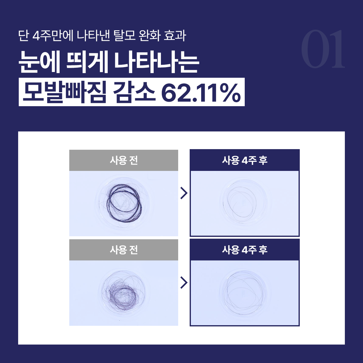 엑솔루트 샴푸 — 식물 유래 엑소좀 두피케어