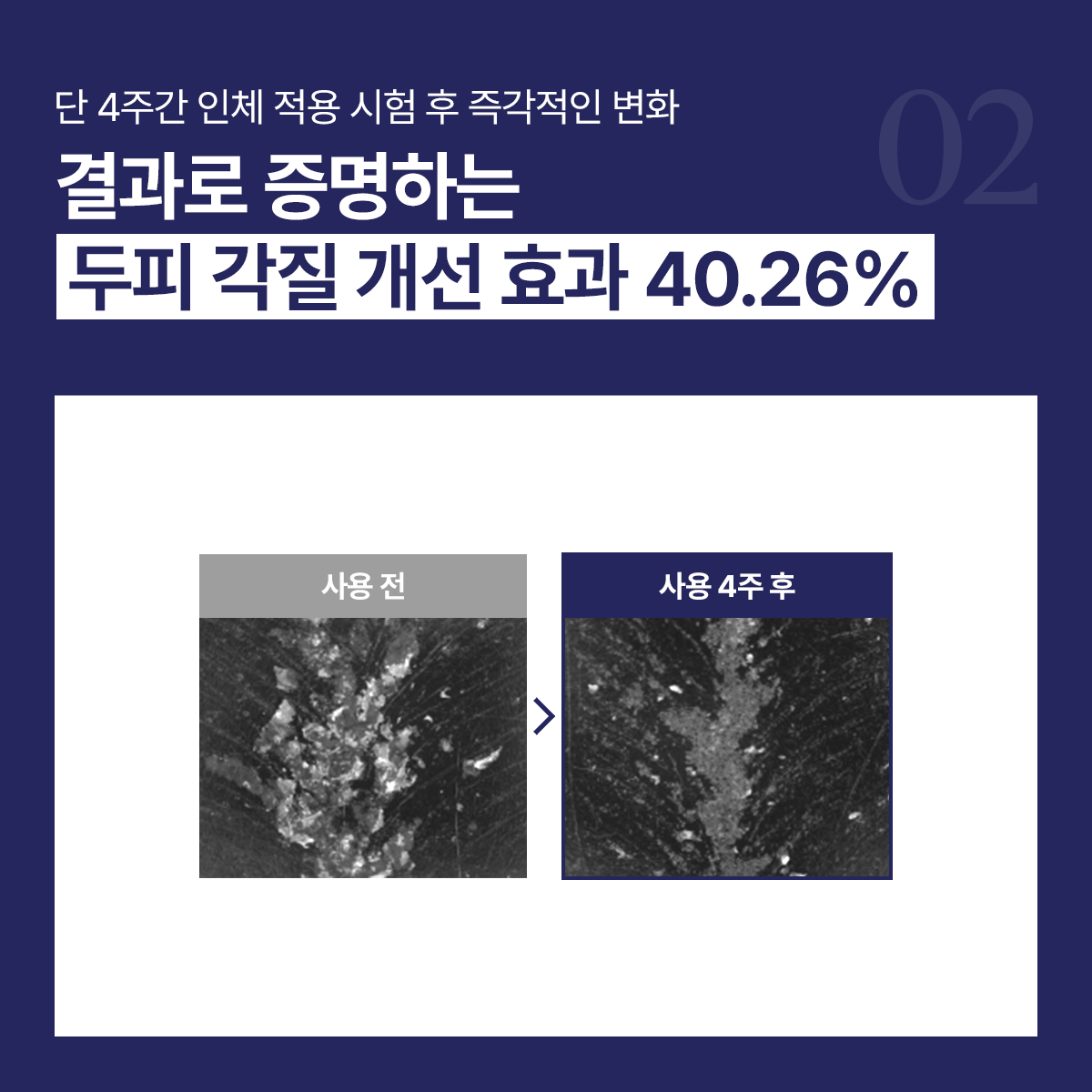 엑솔루트 샴푸 — 식물 유래 엑소좀 두피케어