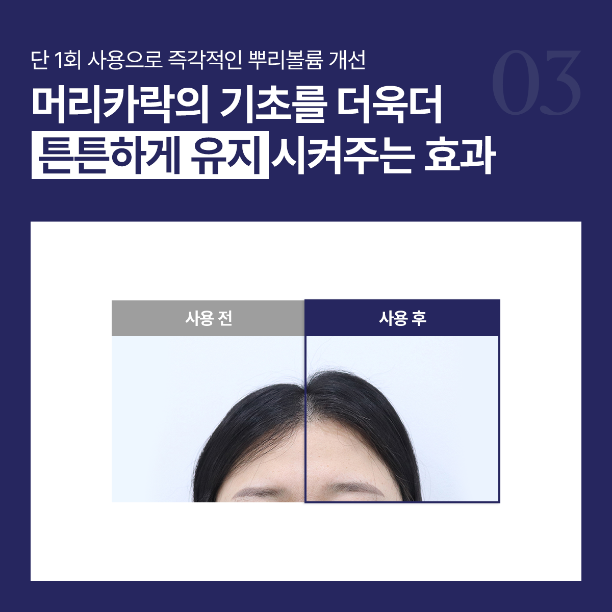 엑솔루트 샴푸 — 식물 유래 엑소좀 두피케어