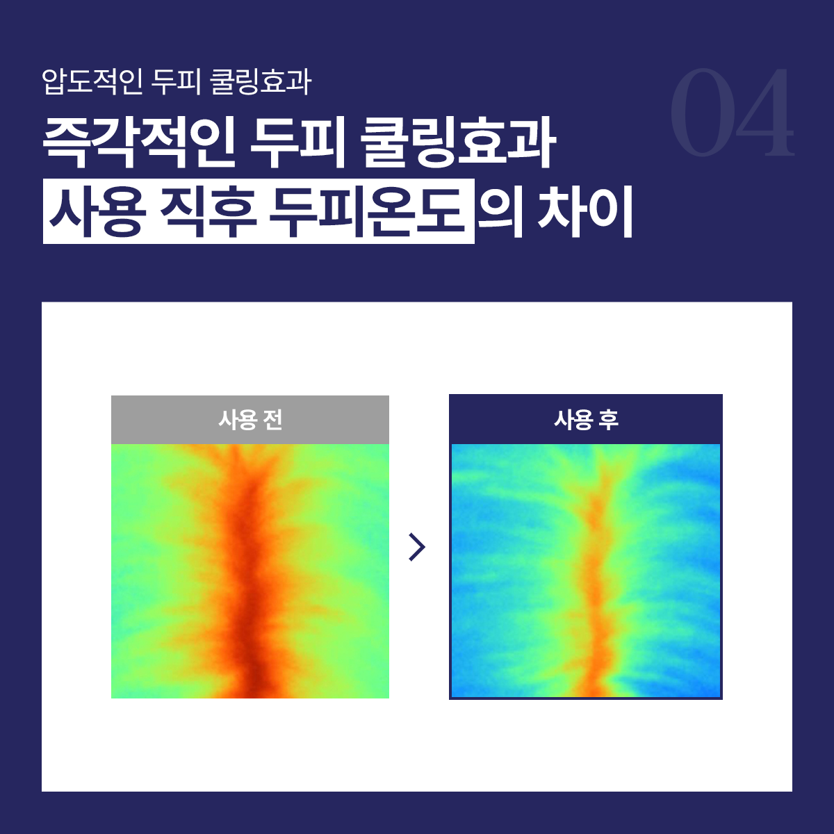 엑솔루트 샴푸 — 식물 유래 엑소좀 두피케어